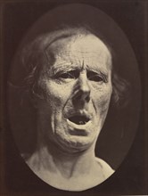 Figure 54: Voluntary lowering of the lower jaw, 1854-56, printed 1862.