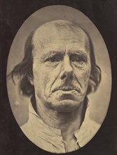 Figure 3: The face of an old man... photographed in repose., 1854-56, printed 1862.