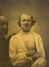 A relaxed expression (left); Disgust (right), 1854-1856, printed 1862.