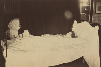 Deathbed Study of Adeline Grace Clogstoun, 1872.  On June 8, 1872, ten year old Adeline Grace Clogstoun died of injuries sustained while rough housing.