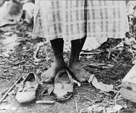 Feet of Negro cotton hoer near Clarksdale, Mississippi, 1937. Creator: Dorothea Lange.