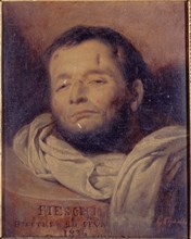 Head of Giuseppe Fieschi (1790-1836), after his execution, 1836.
