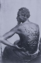 The Scourged Back- The furrowed and scarred back of Gordon, a slave who escaped..., Louisiana, 1863. Creators: Unknown, C. Seaver, Jr..