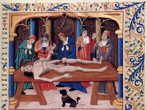 Autopsy. From Livre des propriétés des choses by Barthélemy l'Anglais, 15th century. Creator: Anonymous.