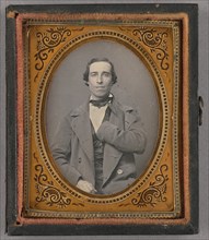 Portrait of a Seated Man with Amputated Left Arm, about 1855. Creator: Unknown.