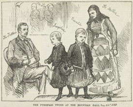 The Pyopagi Twins shown at Egyptian Hall, 1880. Pygopagi twins are conjoined at the buttocks.