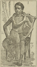 Lalloo, The Greatest Living Wonder on Earth, 1887. Illustration from an advertisement for the