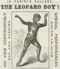 The Leopard Boy! in Farini's Gallery, 1881. 'On View Continuously, Day and Evening. Spotted black,