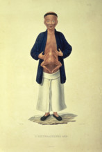 L'heteradelphe Ake, c1824-c1826. A human figure with a body growing from the stomach. The term
