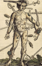 The wound man, 1517. German surgeon Hans von Gersdorff wrote a book with instructions for