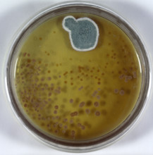 Model of culture dish and Penicillin mould. In 1928, while carrying out research into influenza,