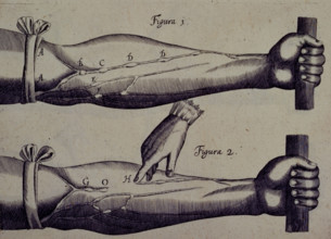 Two arms, and a finger pointing towards a vein, 1628. Creator: Unknown.