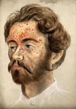 Head of a man with a severe disease affecting his face, (18)60. Creator: Christopher D'Alton.