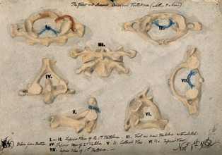 The first and second cervical vertebrae, 1852/11/09. Creator: J.C. Whishaw.