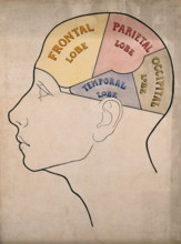 Head of "a backward boy" divided into four cerebral lobes: profile, c1900. Creator: Bernard Hollander.