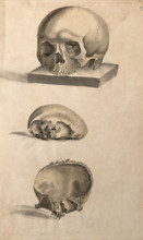 Human skull: three figures showing sections and an entire skull, 1830-1835. Creator: Unknown.