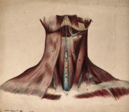 Dissection of the back of the neck, 1854/03/16. Creator: J.C. Whishaw.