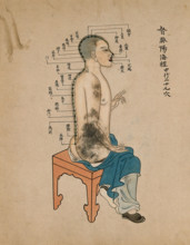 Acupuncture chart with a series of points indicated on the figure of a seated Chinese man, 1700-1799 Creator: Unknown.