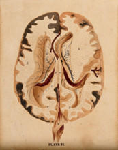 Brain: horizontal section showing lateral ventricles, 1820-1827. Creator: William Home Lizars.