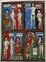 Four vignettes demonstrating different cauterisation points on naked human bodies. Creator: Unknown.