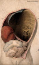 A dissected thorax with a collection of pus in the cavity, c1824. Creator: Unknown.