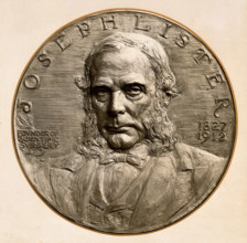 Joseph Lister, 1st Baron Lister, 1800-1899. Creator: JB Wendt.