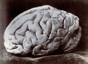 A brain, viewed from the side, supposedly from a subject with mental deficiency. Creator: N. Goulton May.