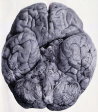 Friern Hospital, London: a brain, seen from beneath, 1890/1910. Creator: Unknown.