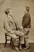 Down's syndrome: in two young men holding hands, one sitting and one standing, c1880s. Creator: Unknown.
