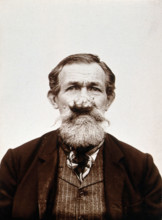 A patient of Léon Desguin, before operation, c1890s. Creator: Unknown.