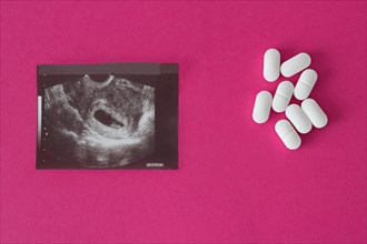 Uzi of pregnancy on a pink background and pills, abortion.