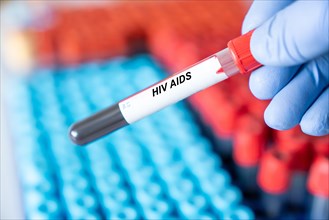 Hiv Aids. Hiv Aids disease blood test in doctor hand