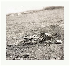 American Civil War: The horrors of war, Confederate soldier killed by a shell at the battle of