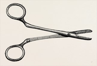 spencer wells's artery forceps, medical equipment, surgical instrument, history of medicine