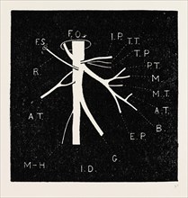 diagram, medical equipment, surgical instrument, history of medicine