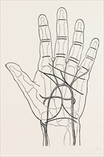 surface markings on the palm of ffile hand, the thick black lines represent the chief creases of