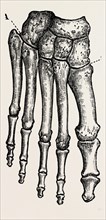 bones, medical equipment, surgical instrument, history of medicine