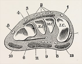transverse section, medical equipment, surgical instrument, history of medicine