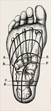 plantar incisions, medical equipment, surgical instrument, history of medicine