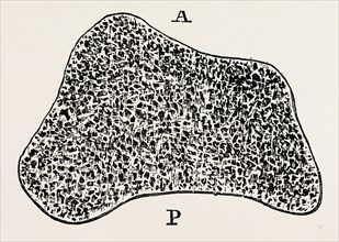 transverse section, medical equipment, surgical instrument, history of medicine