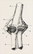 restoration, medical equipment, surgical instrument, history of medicine