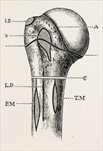 diagram, medical equipment, surgical instrument, history of medicine