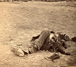 A dead rebel soldier, inside the Union picket lines, US, USA, America, Vintage photography