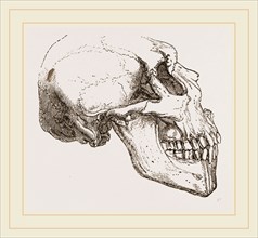Skull of Human Idiot