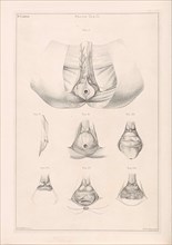 Anatomy of the pelvis, Jacob van der Schley, 1762