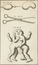 Anatomical image XV, Jan Luyken, Jan Claesz ten Hoorn, 1680 - 1688
