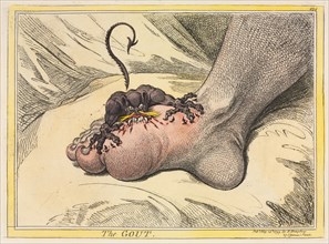 The Gout, 1799. James Gillray (British, 1757-1815), Hannah Humphrey. Etching hand-colored with