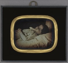 Postmortem of a Child; Carl Durheim, Swiss, 1810 - 1890, about 1852; Daguerreotype, hand-colored