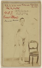 W. D. Gilbert Co, C. 6th Vt. Civil War Victim; American; 1865; Albumen silver print