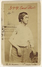 Russell B. Mason Prv. 7th Mich. Inf; Baldwin & Prior, American, 1865 - 1867, about 1865; Albumen silver print